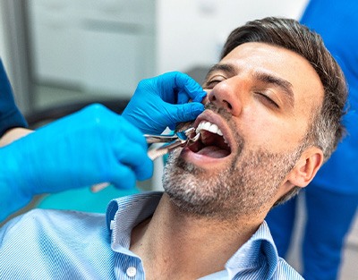 A man having his tooth extracted