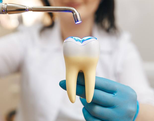 Dentist demonstrating how resin is hardened on model tooth